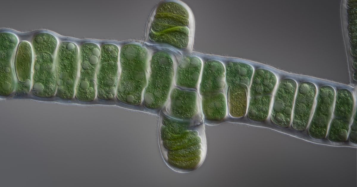 Cyanobakterie, die Biokunststoff produzieren kann (Quelle: Hochschule KL/Håkan Kvarnström)